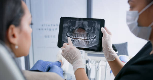 Licensed Teeth Whitening service in Patterson, LA - Smile Center Dentistry